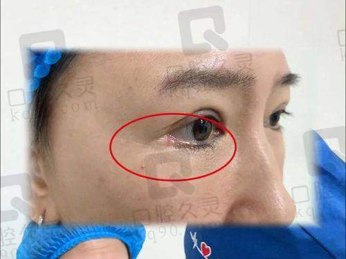 个体差异与遗传因素