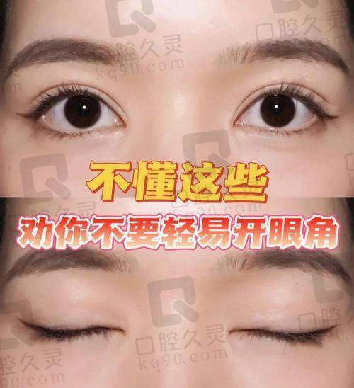 实际实例分析与后期处理