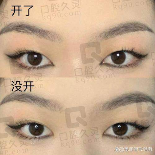 术后护理的重要性与影响
