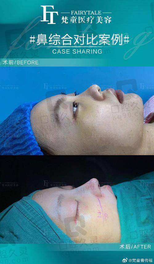 客户实际实例及反馈