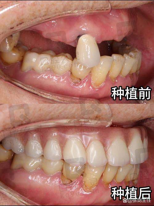 浙江杭州中瑞联合口腔张弘医生擅长项目