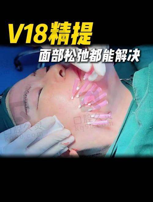 广州中家医家庭医生朱云微拉美埋线面部提升29750元起——真实实例分享