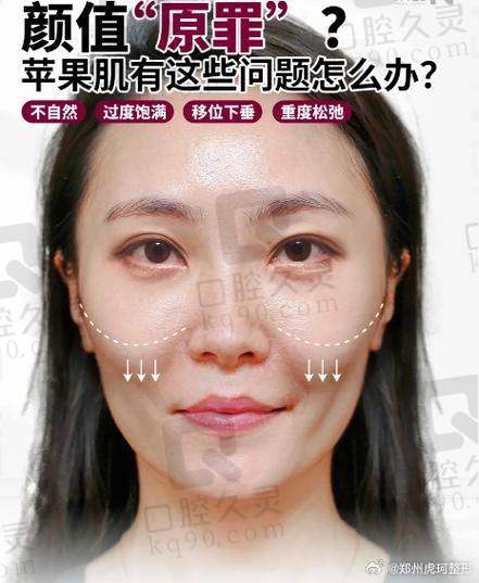北京加减美整形医院苹果肌复位：2025价格透明，真人案例见证，技术优服务佳值得选 
