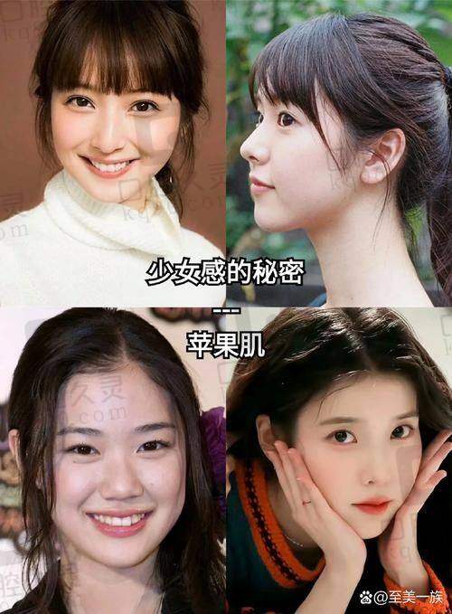 二、北京加减美整形医院苹果肌复位：真人实例大揭秘
