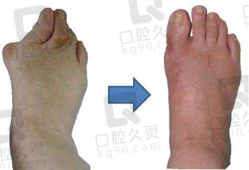 济南艺星在双眼皮手术方面有哪些优势？