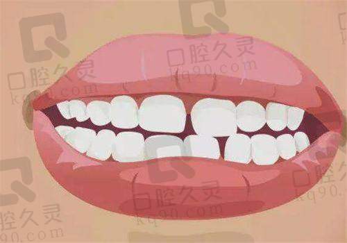 總結