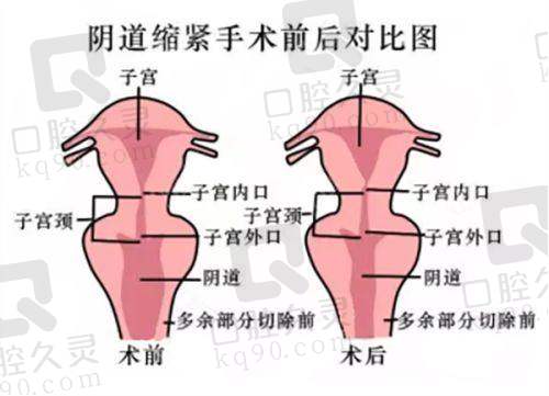 吴晓莉医生的号现场不能挂，现已排到2026年，这有快速免费预约攻略确定不看？
