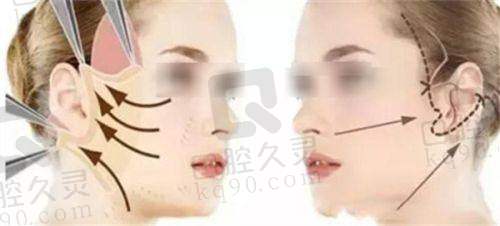 嘉兴韩辰医疗美容金洪奭的口碑评价