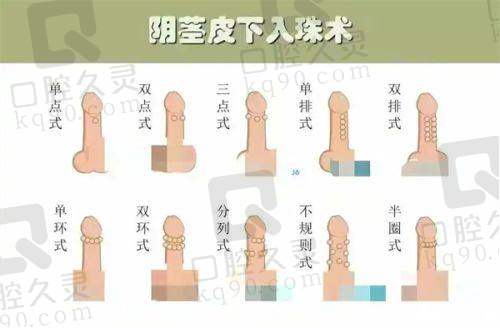 济南艺星整形医院的风险管控措施有哪些？