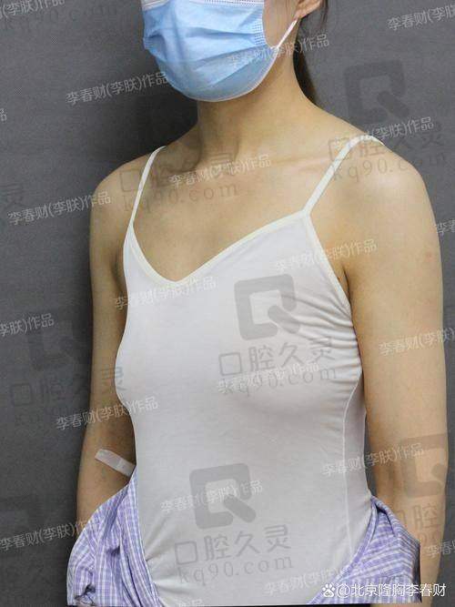 广州中家医家庭医生朱云德国宝俪假体隆胸26750元起，够获得自然美的胸部形态，而不仅仅是够大的尺寸