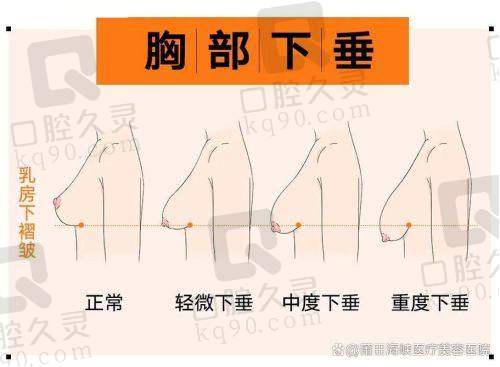广州中家医家庭医生朱云德美假体隆胸15750元起——行业数据分析