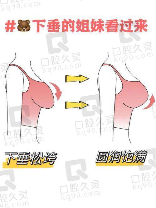 济南艺星杨季涛提升胸部怎么样？专业技术、丰富经验打造理想美胸效果 