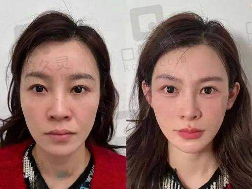 总结