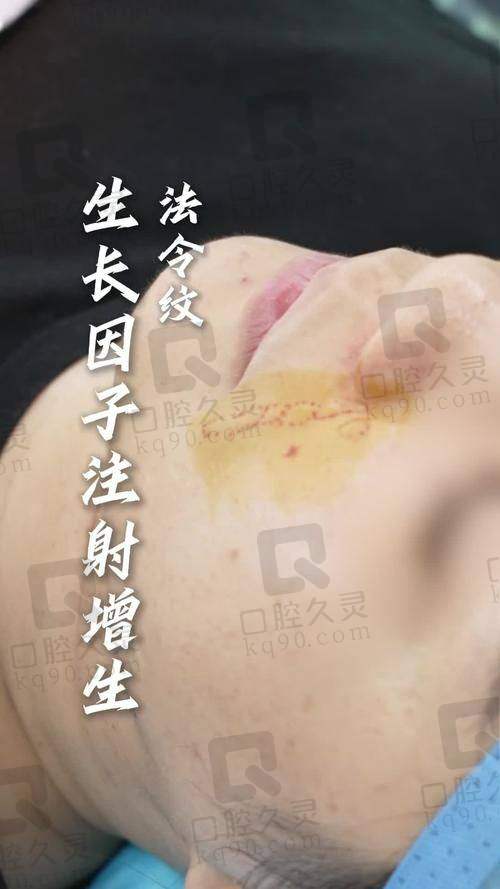 济南艺星的医生技术怎么样？