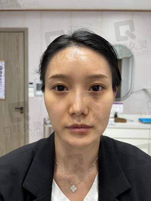 二、不同渠道和场景下“玻尿酸一次的价格是”