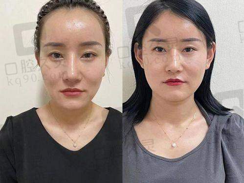 洛阳打瘦脸针哪里好？这些正规医院实力强，专家多且项目价格透明 
