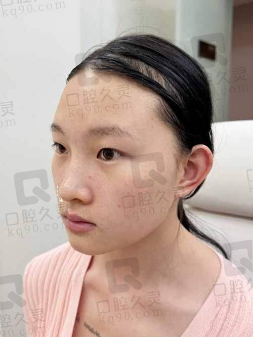 如何应对濡白天使的回落和再生