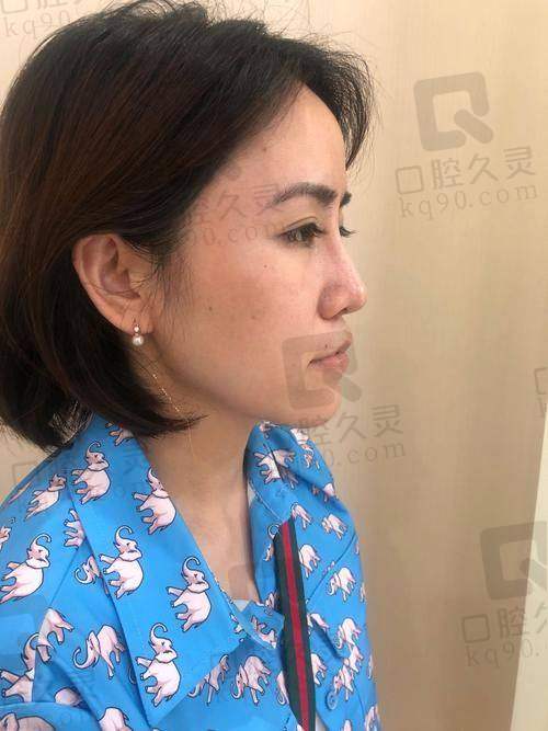 濡白天使多久再生