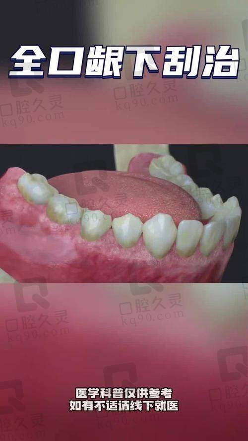 苏州美奥口腔医院牙周刮治12颗套餐1900元起，徐连来、刘有鑫医生实力守护口腔健康