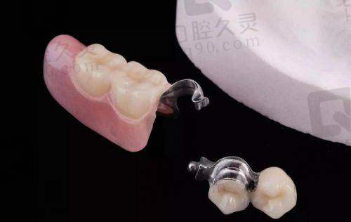 五、如何选择高性价比的全口活动牙方案