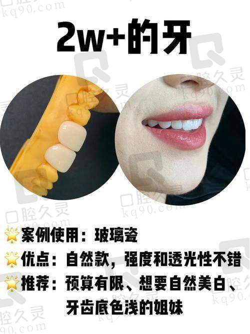 牙齿贴面美白前要做哪些检查？