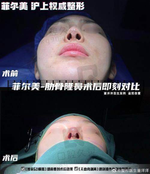 三、郑州153空军 医院八一美容，用户实例分享