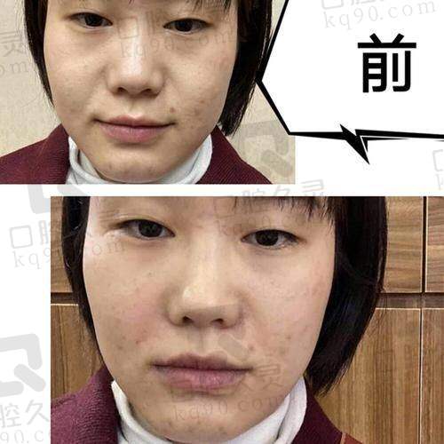 长期成效如何？