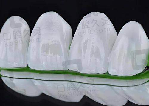 福州登特口腔医院牙齿贴面美白技术有什么特色？