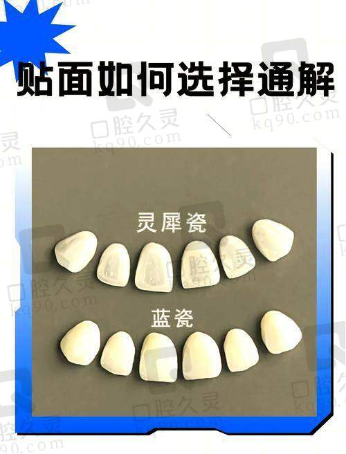 福州登特口腔医院是怎样的存在？