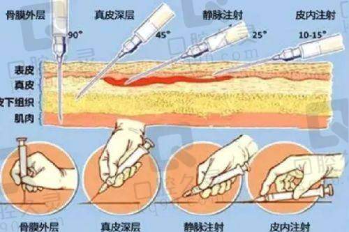 五、台州爱莱美整形门诊部实例