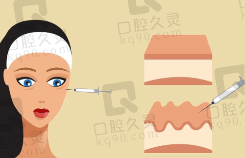 曼托假体光面与毛面的区别