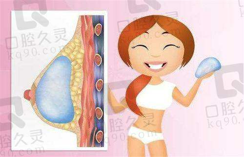 曼托毛面圆形凝胶乳房假体——高型