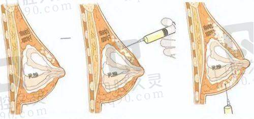石家庄美莱马静医生：美学与医学的融合