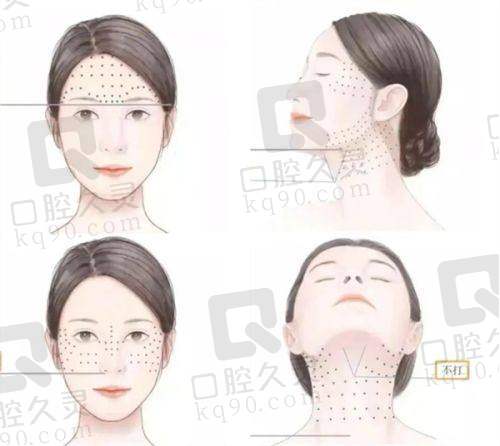 重庆松山医院罗会良胸部整形水平怎么样 ？