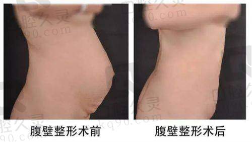 石家庄美莱医学美容医院口碑好吗？专业团队与规范收费获广泛赞誉
