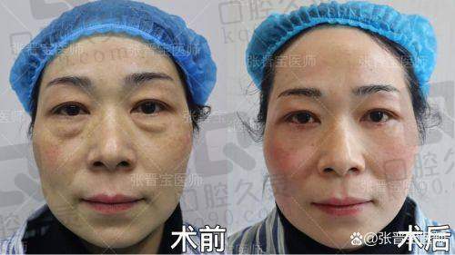 广州中家医家庭医生易普锋的费用分析