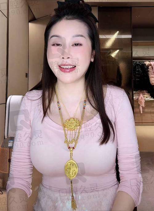 刘月更隆鼻：三维骨支架系统打造精致比例脸