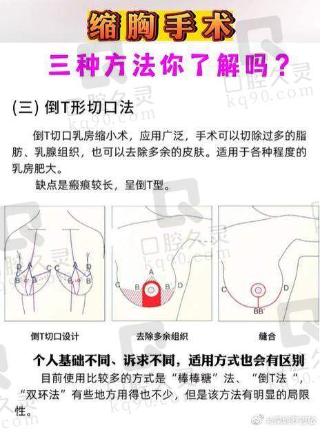 宝妈成效见证篇：术后注意事项真的特别关键，影响维持年限
