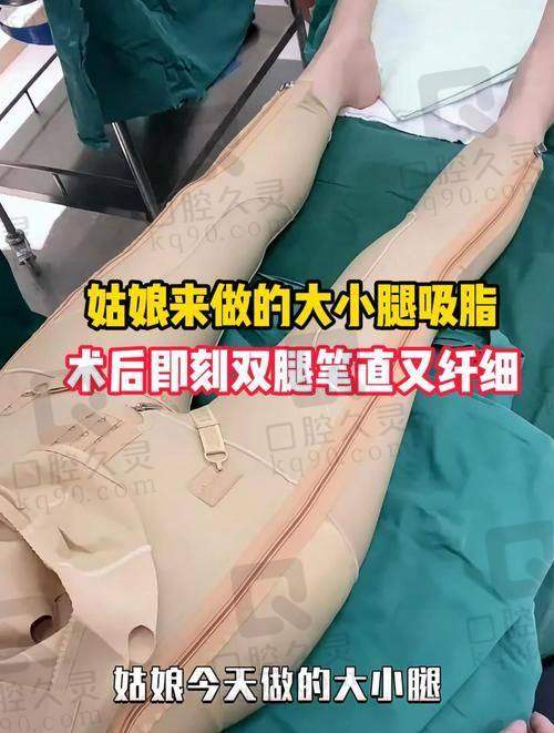 广州中家医家庭医生易普锋水动力小腿吸脂的优势