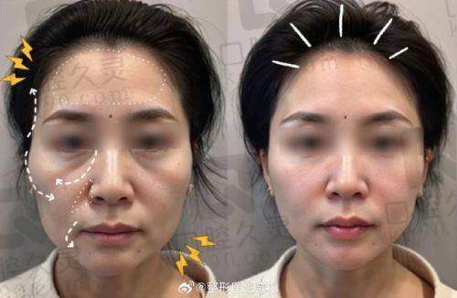 广州中家医家庭医生赵慧慧的实际实例