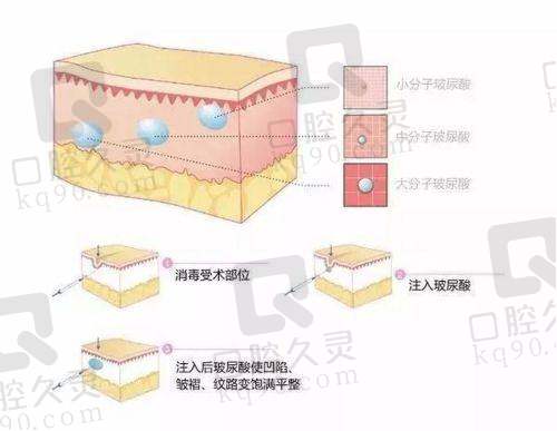 广州中家医家庭医生赵慧慧弗嫚胶原蛋白的行业数据支持