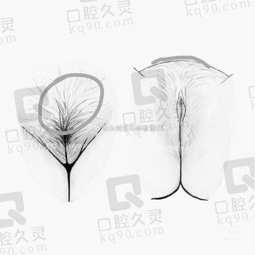 成都棕南医院的医生在私密手术中有哪些优势？