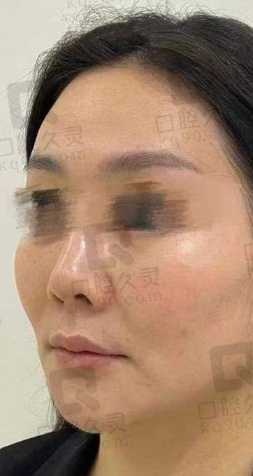易普锋广州中家医家庭医生坐诊，专业埋线提升技术16750元起，提升面部紧致度和轮廓感，预约挂号轻松便捷，了解更多信息！