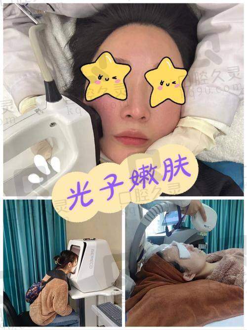 专精医师：为光子嫩肤保驾护航