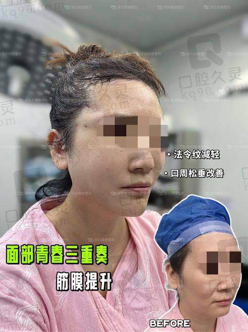 7. 厦门荟美天成整形医院 - 科学整形与美学相结合
