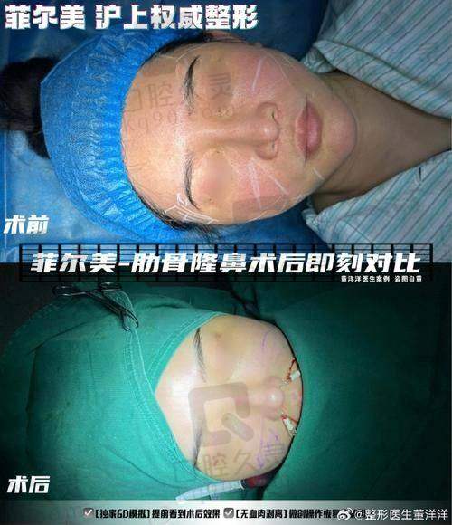 4. 厦门华美名媛医疗美容医院 - 抗衰老与眼部整形的佼佼者