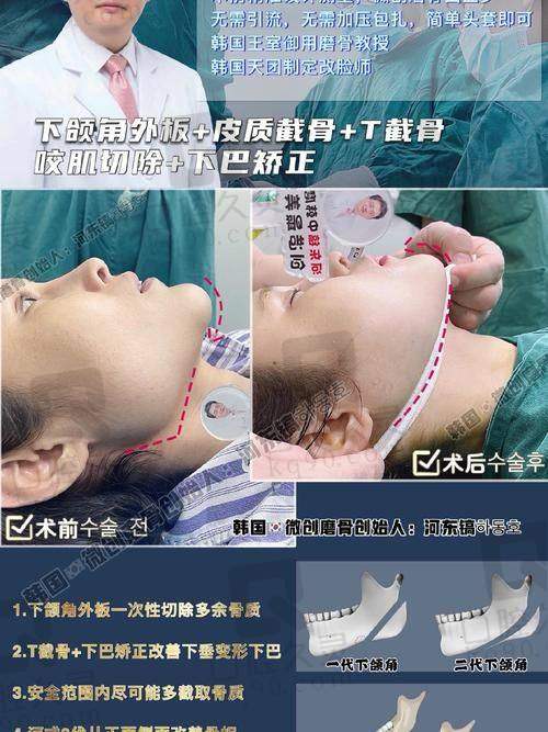 五、沈绍勇 7D 榫卯技术改脸型价目表及省钱妙招