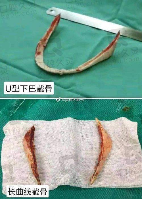 三、沈绍勇 7D 榫卯技术的优势