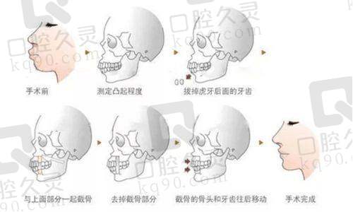 南宁华美医疗美容医院张晴医生预约方式