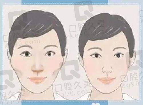 南宁碧莲盛植发医院口碑评价：